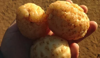 Patates Siğil Hastalığı Nedir Neden Olur